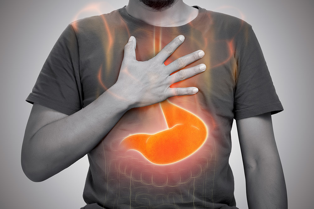 8 Ways to Remedy Acid Reflux Without Medication