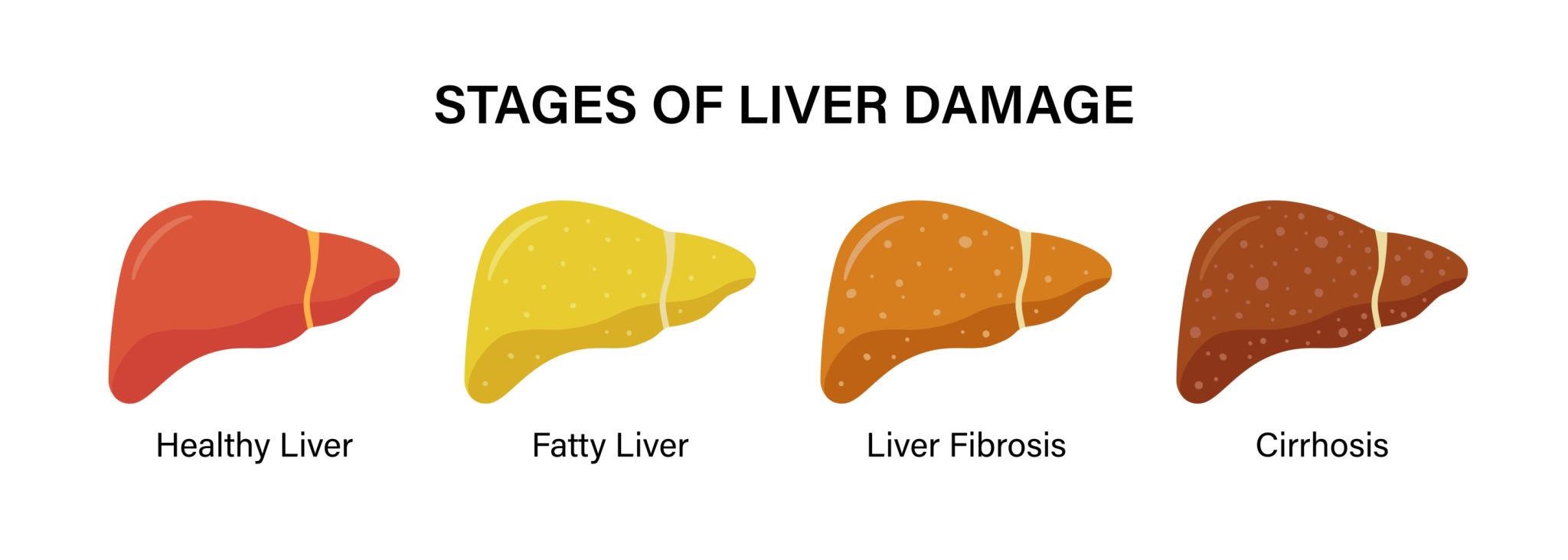 Can Diabetes Affect the Liver?