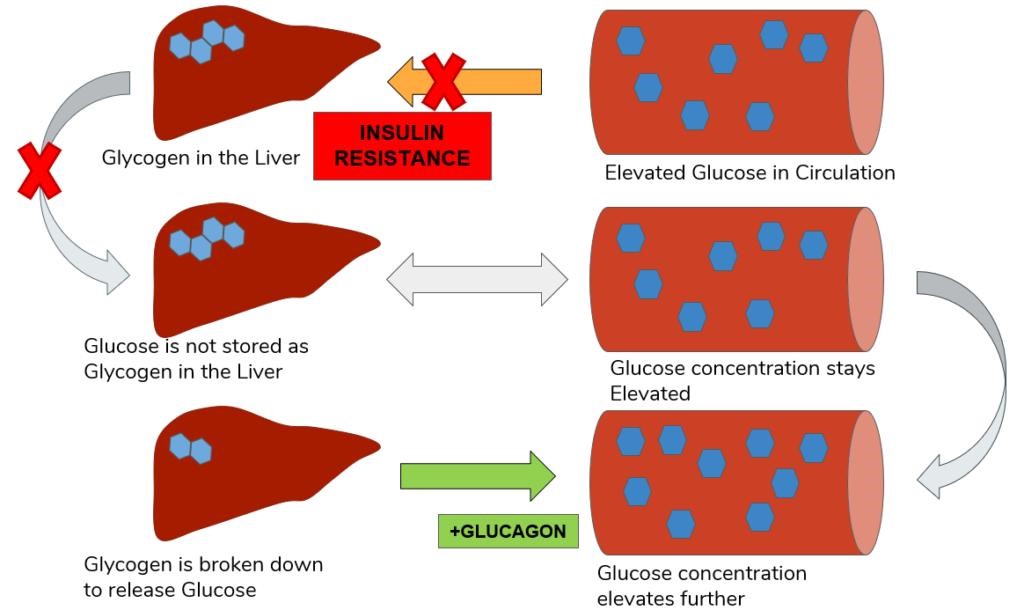 Can Diabetes Affect the Liver?