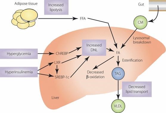 Can Diabetes Affect the Liver?