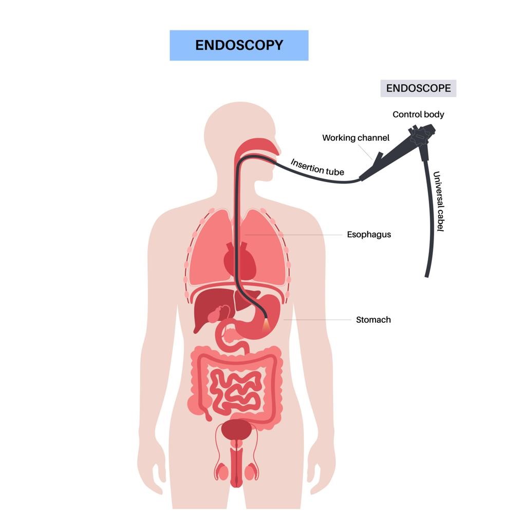 Can Diabetes Cause Stomach Pain?