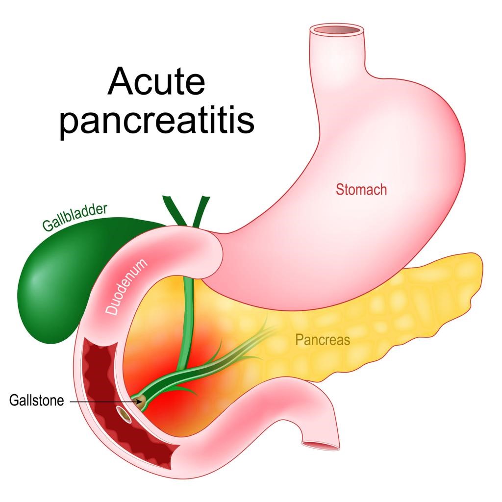Can Diabetes Cause Stomach Pain?