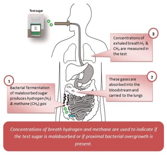 Diabetes and Gut Health: The Hidden Connection