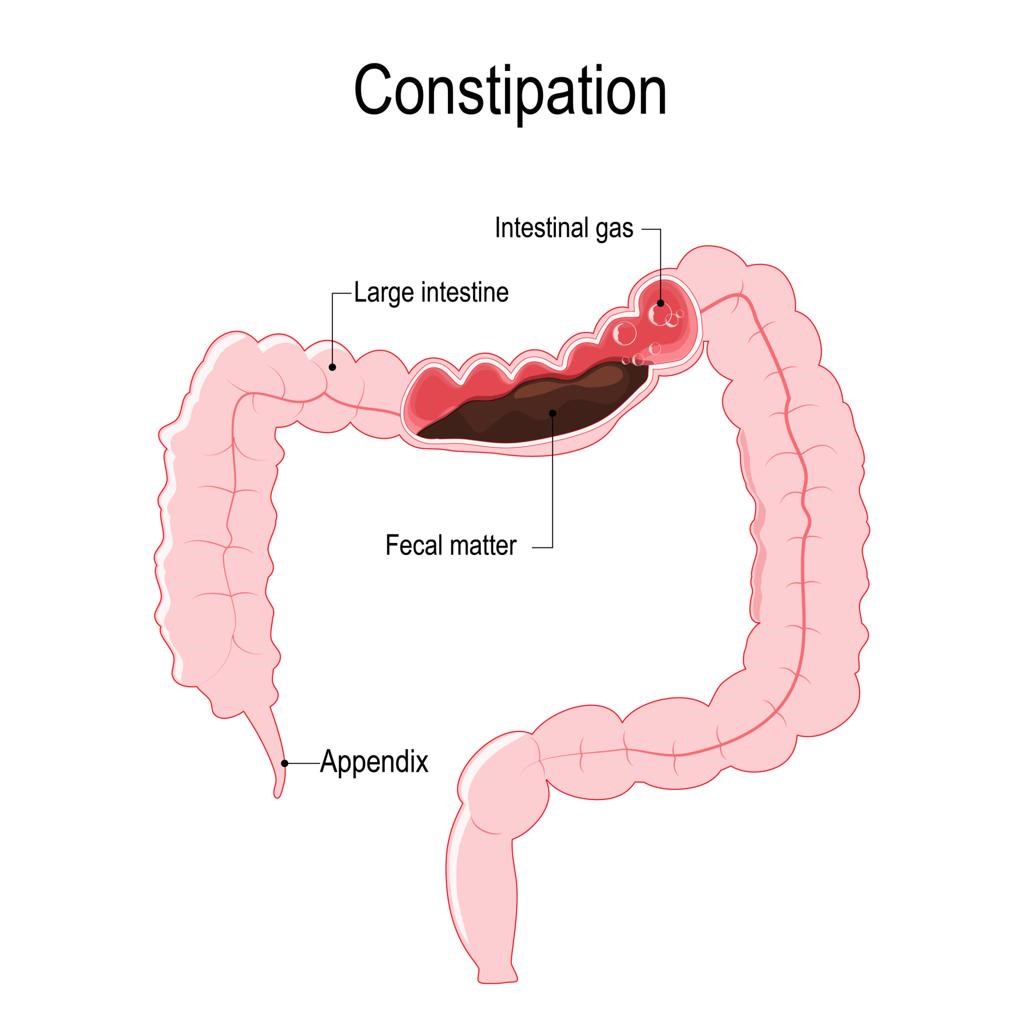 Diabetes and Gut Health: The Hidden Connection