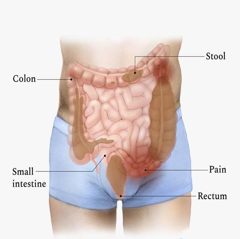 How Does Diabetes Affect the Gastrointestinal System?