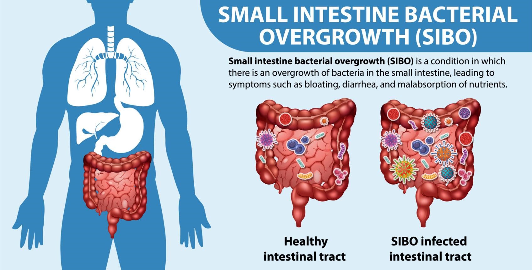 How Does Diabetes Affect the Gastrointestinal System?