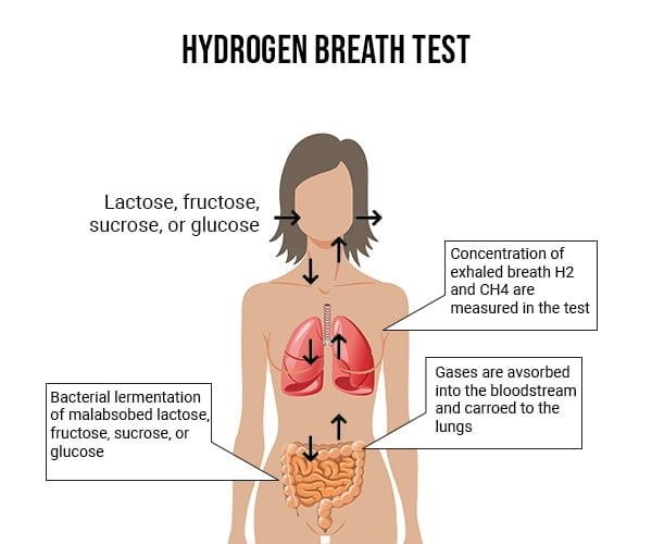 How Does Diabetes Affect the Gastrointestinal System?