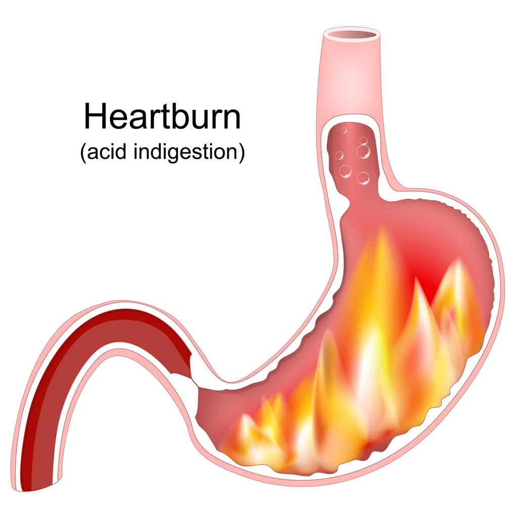 How Does Diabetes Affect the Gastrointestinal System?