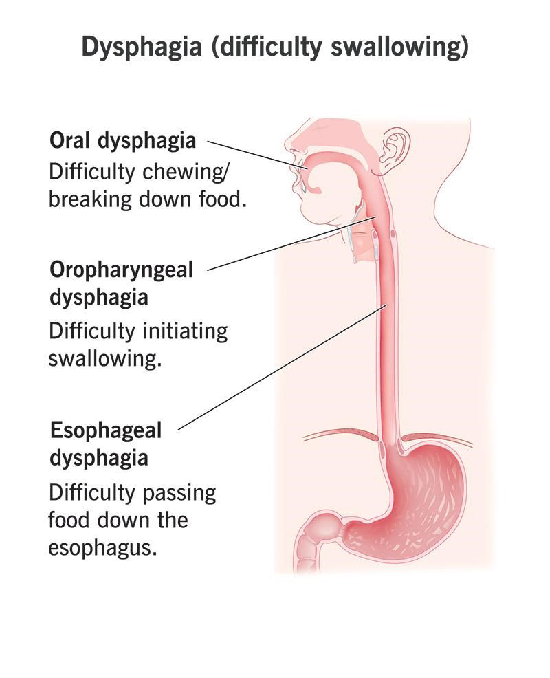 How Does Diabetes Affect the Gastrointestinal System?