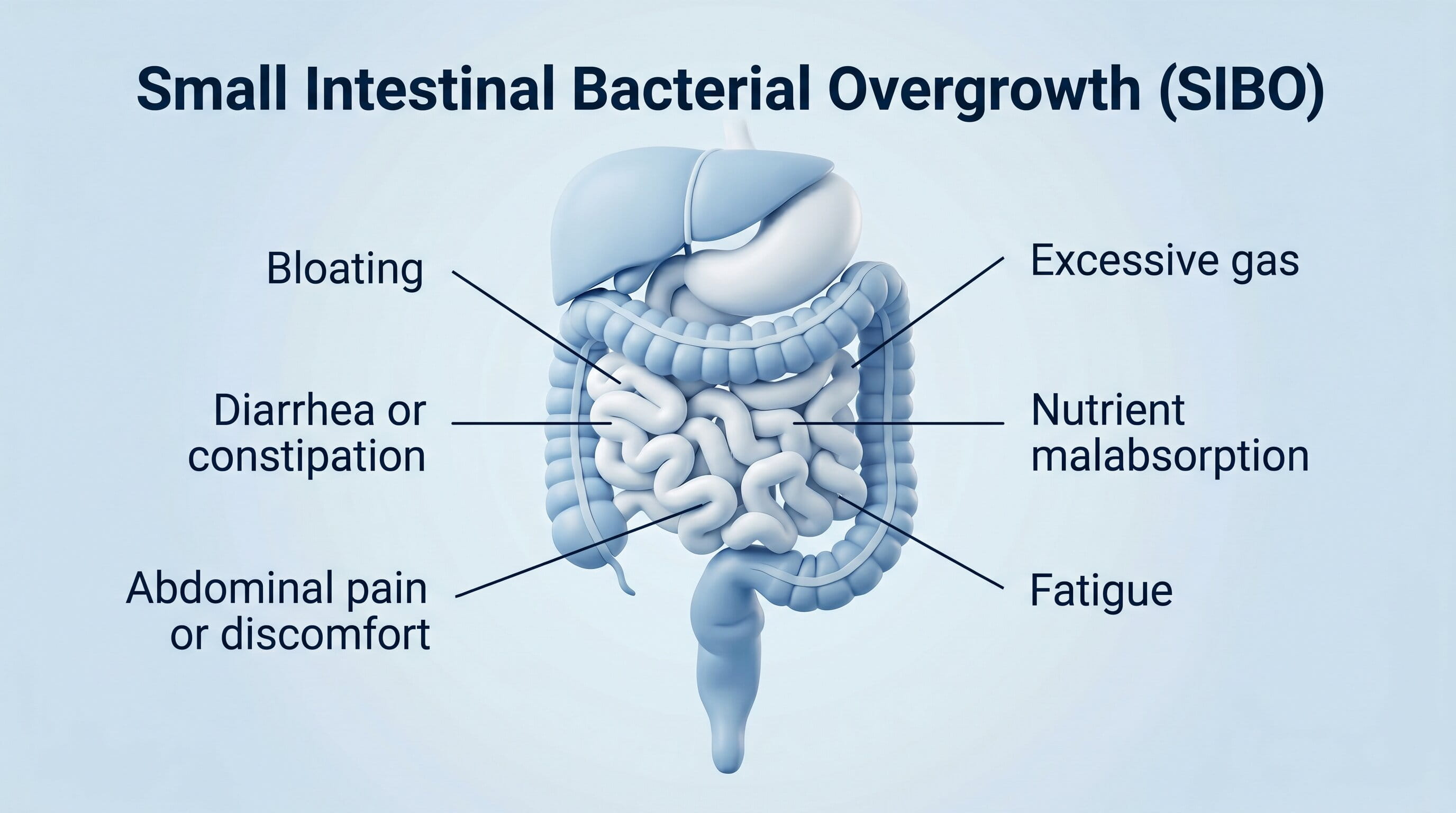 SIBO vs IBS: How to Differentiate Small Intestinal Bacterial Overgrowth from Irritable Bowel Syndrome