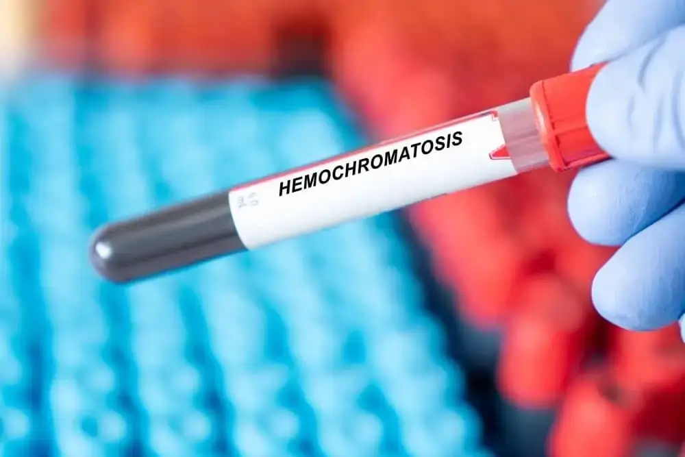 What is Hemochromatosis? Signs and Symptoms to Watch For