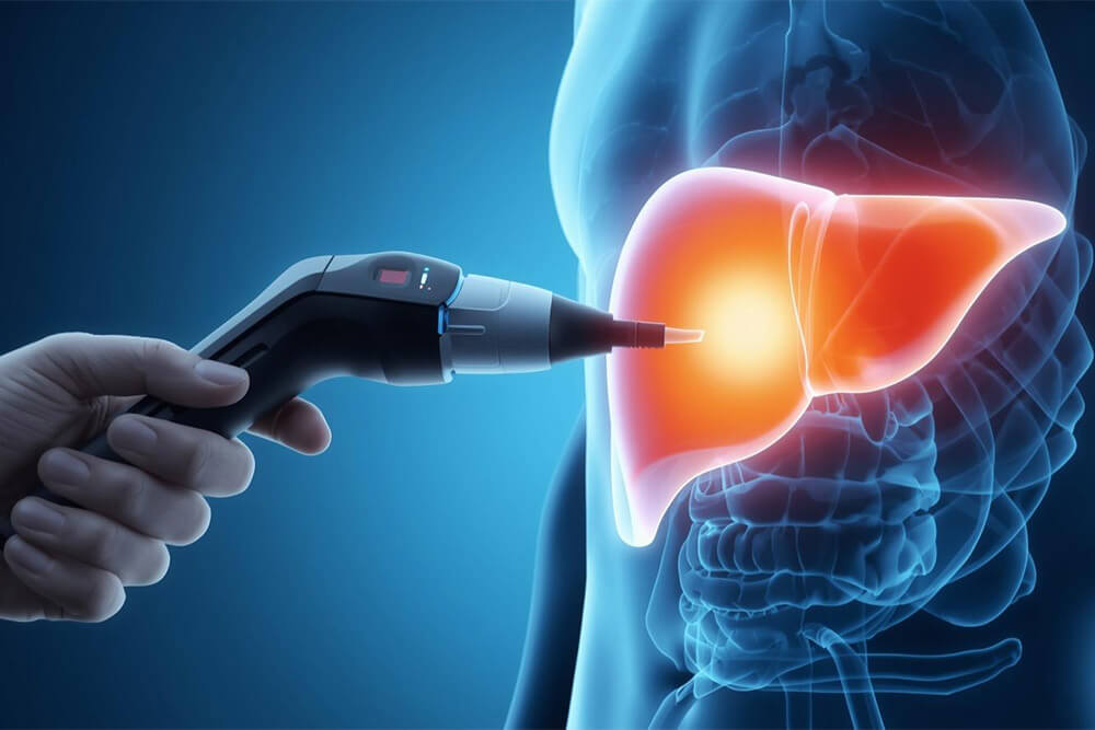 Why You Should Consider FibroScan for Early Liver Disease Detection in Katy, TX