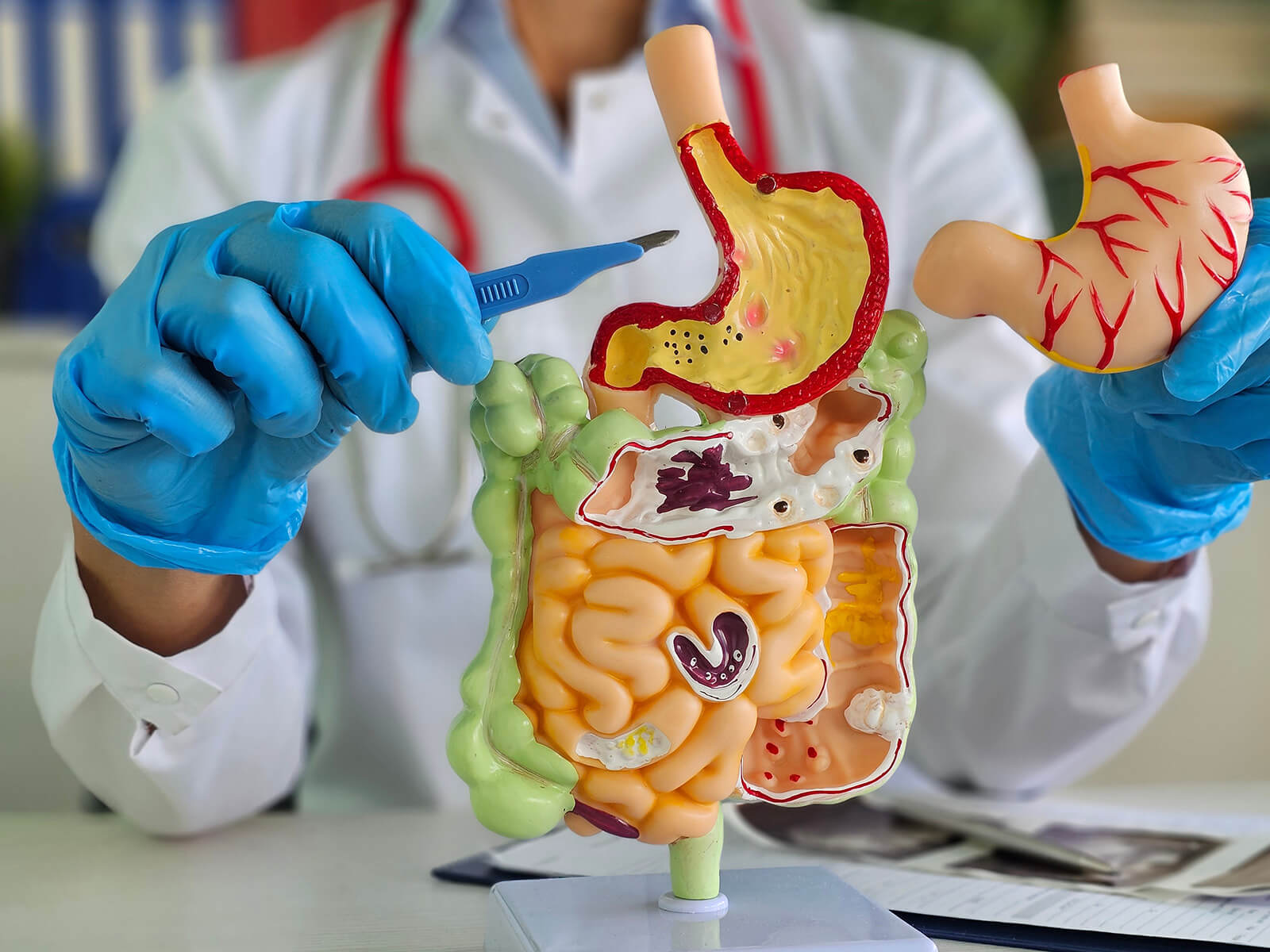 Duodenal