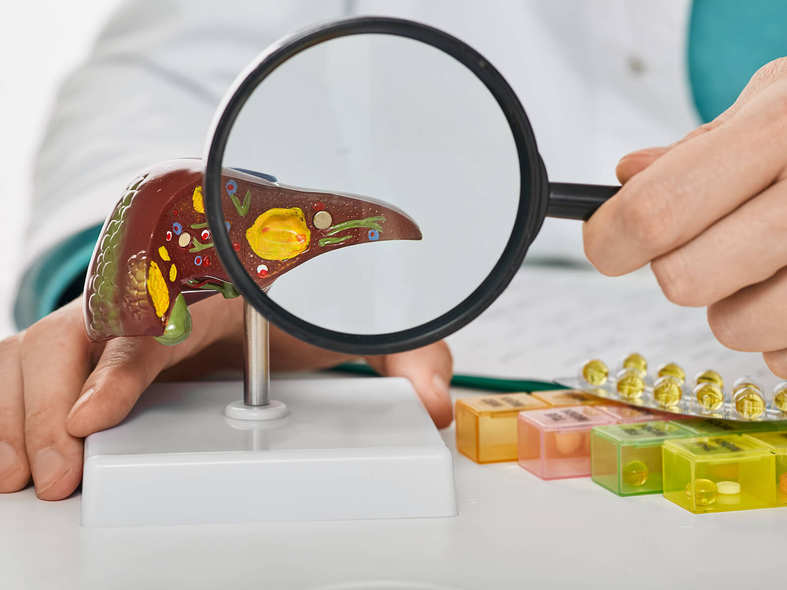 Gallstones
