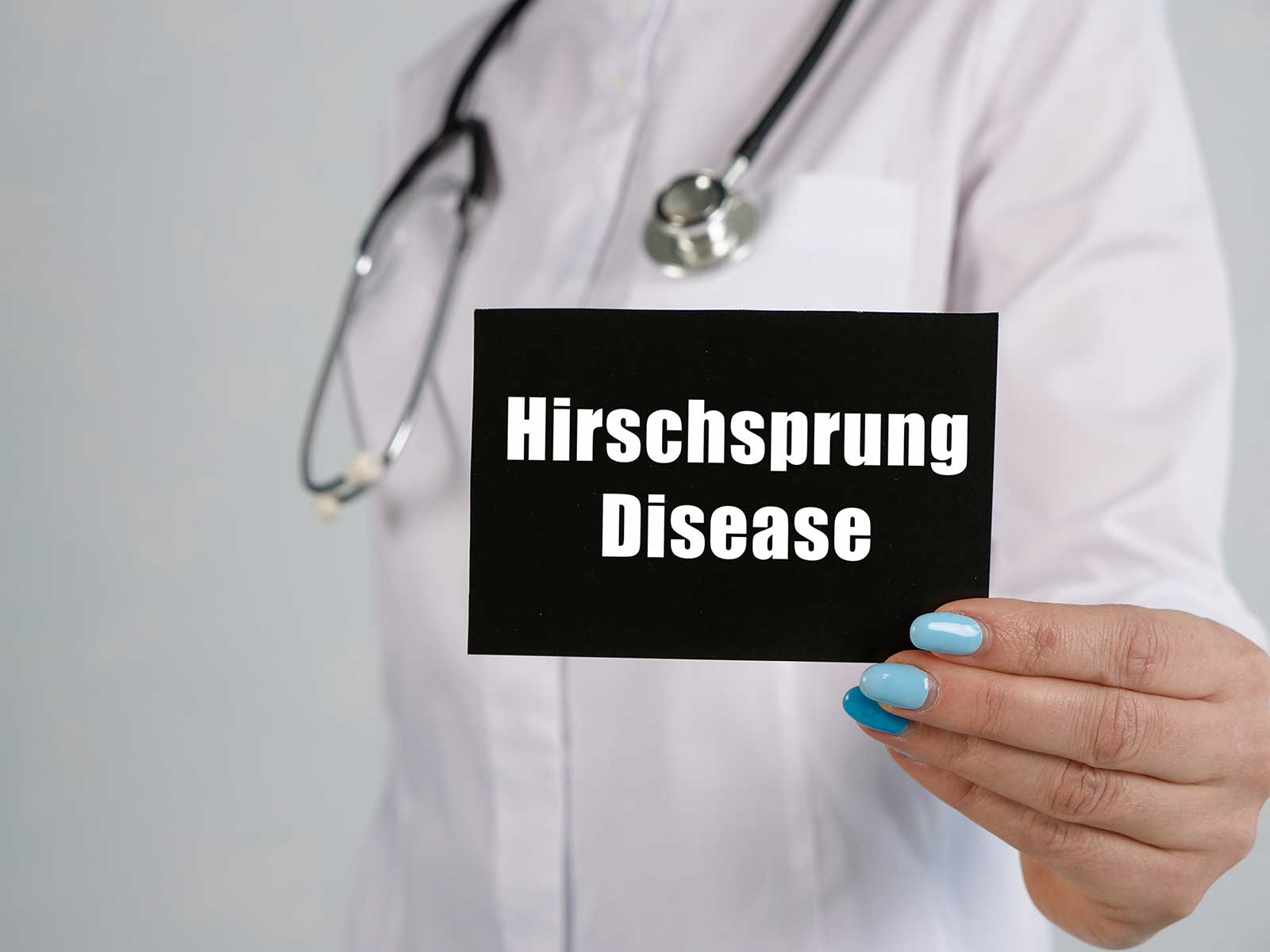 Hirschsprug's
