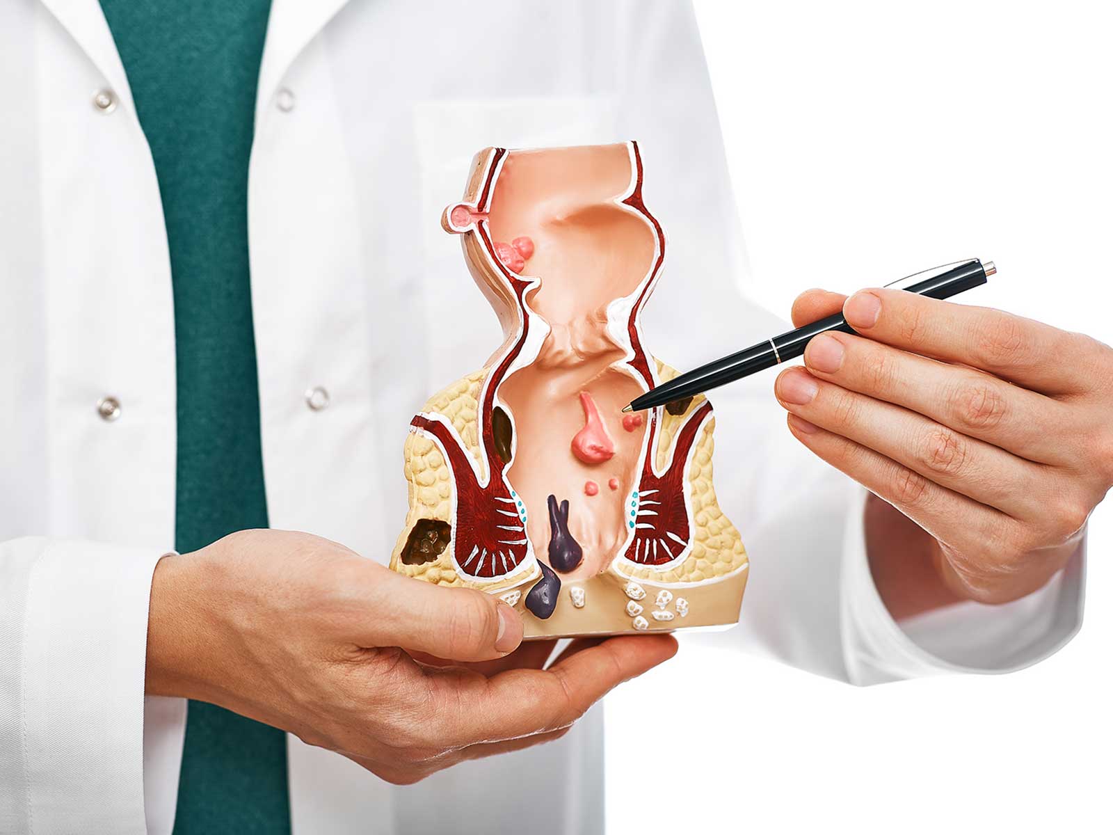 Colonic
