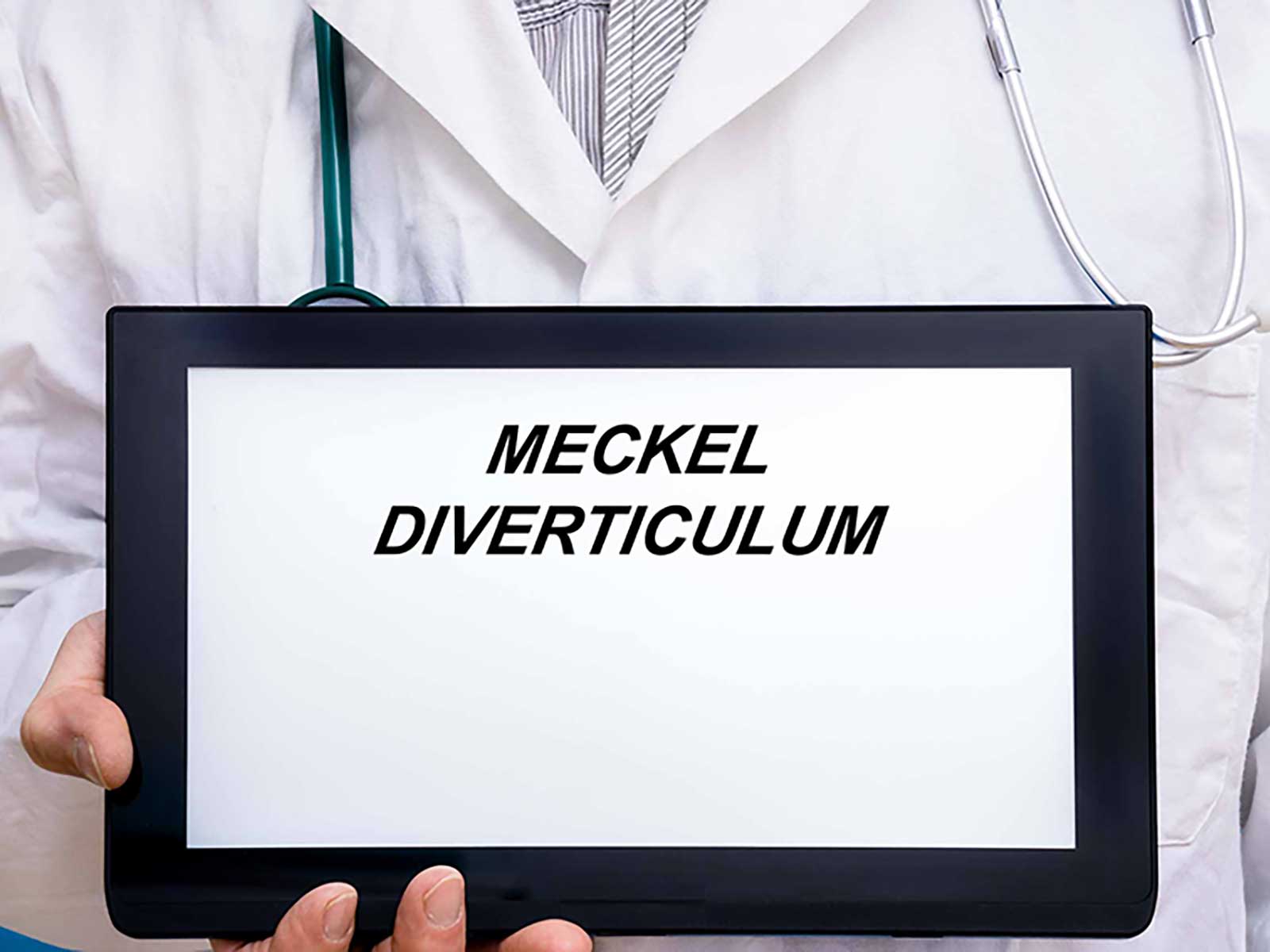 Meckel's