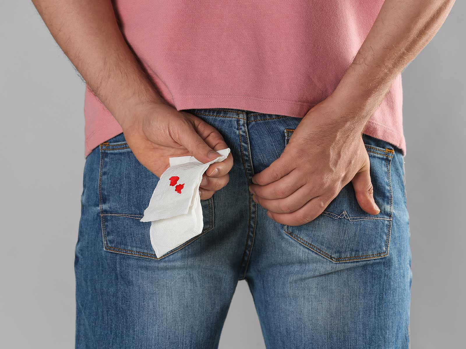 Rectal