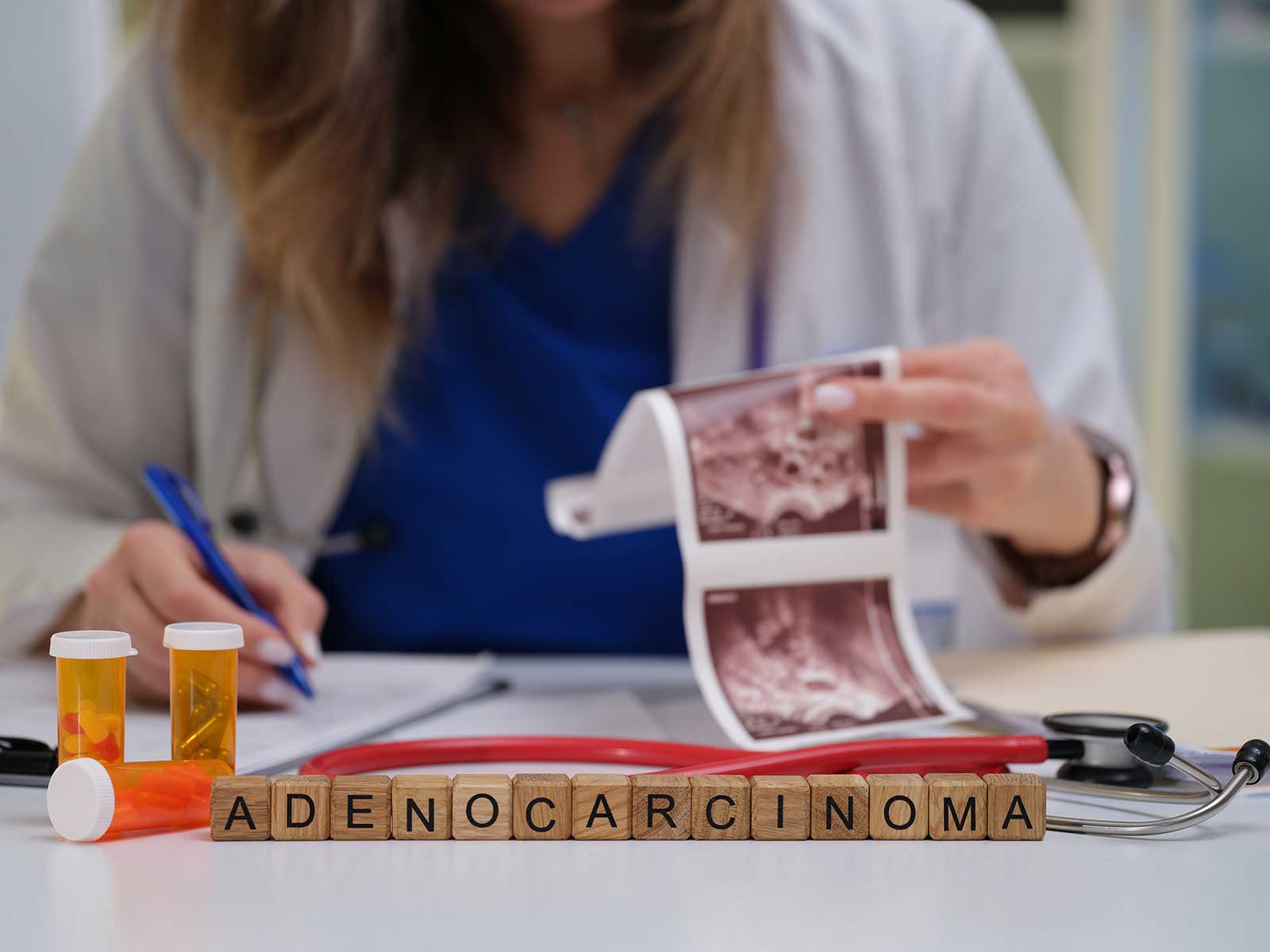 Adenocarcinoma