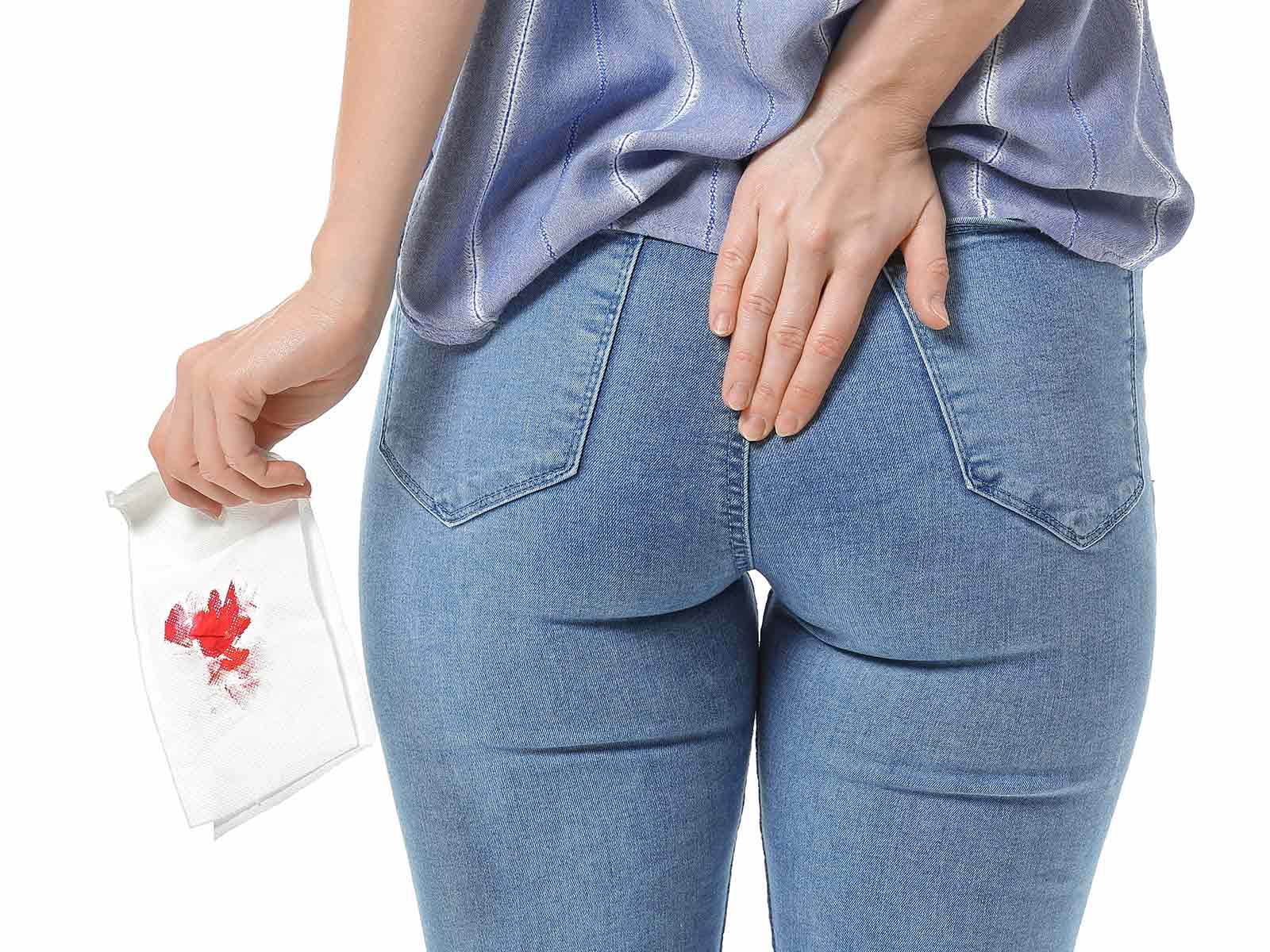 Diverticula