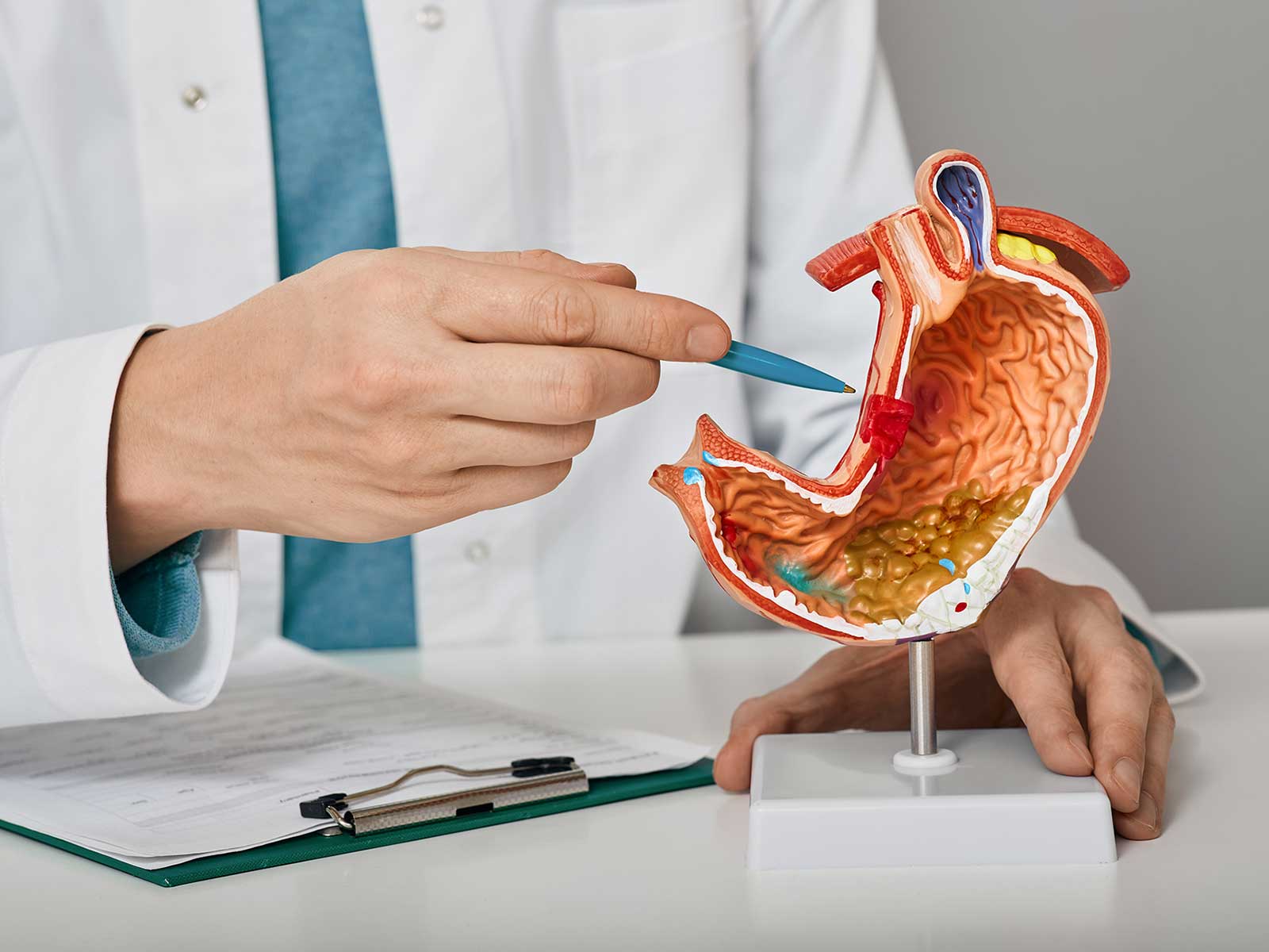 Gastric