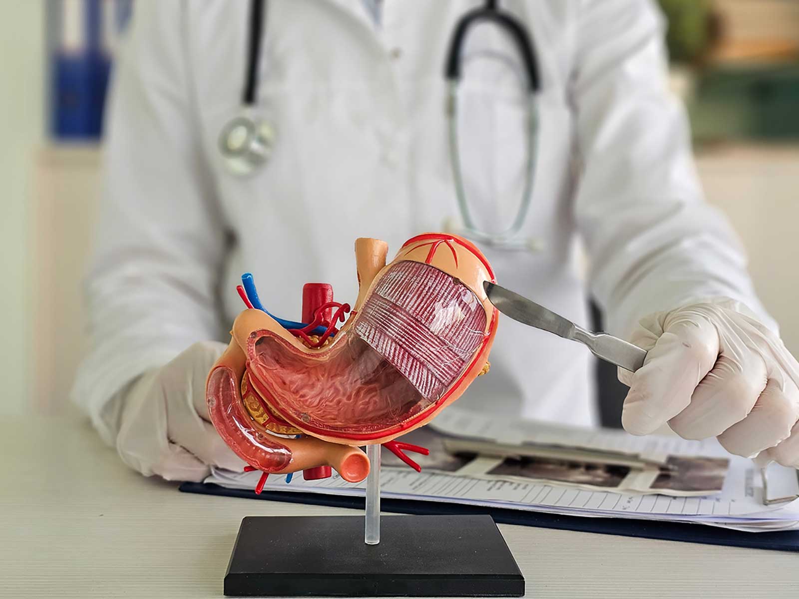 Gastric