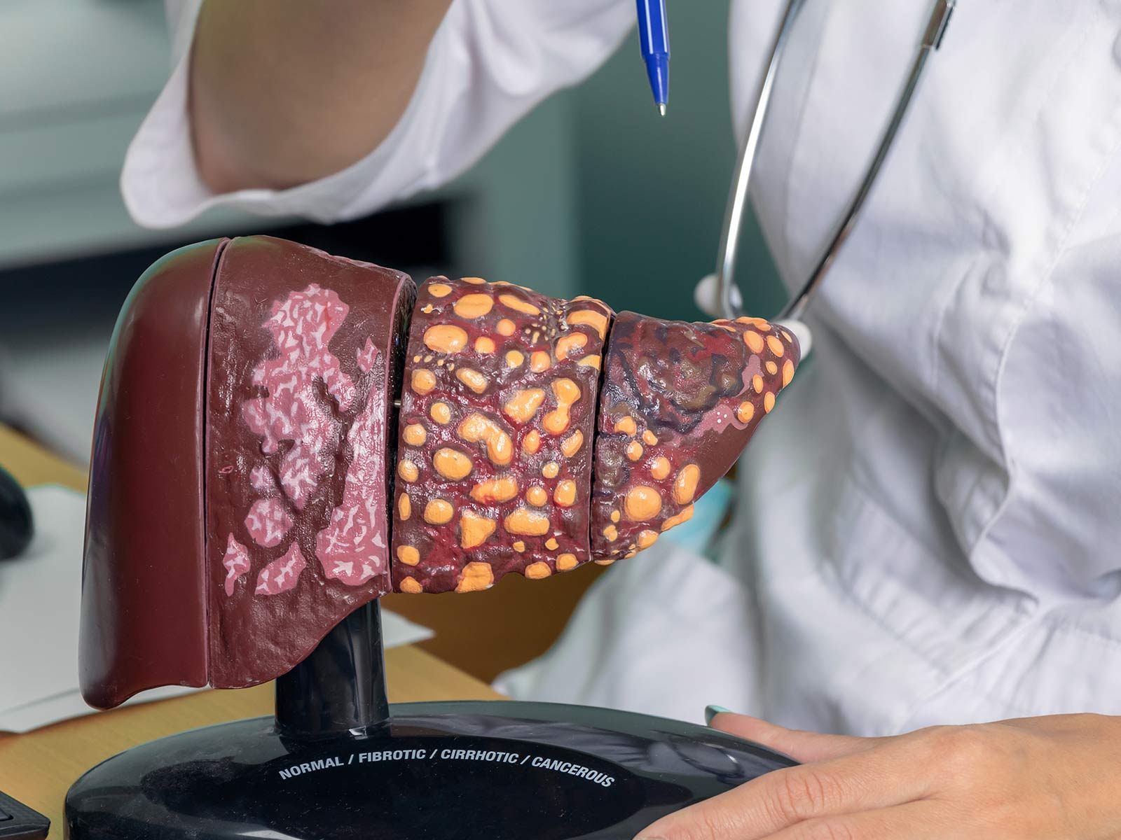 Hepatic