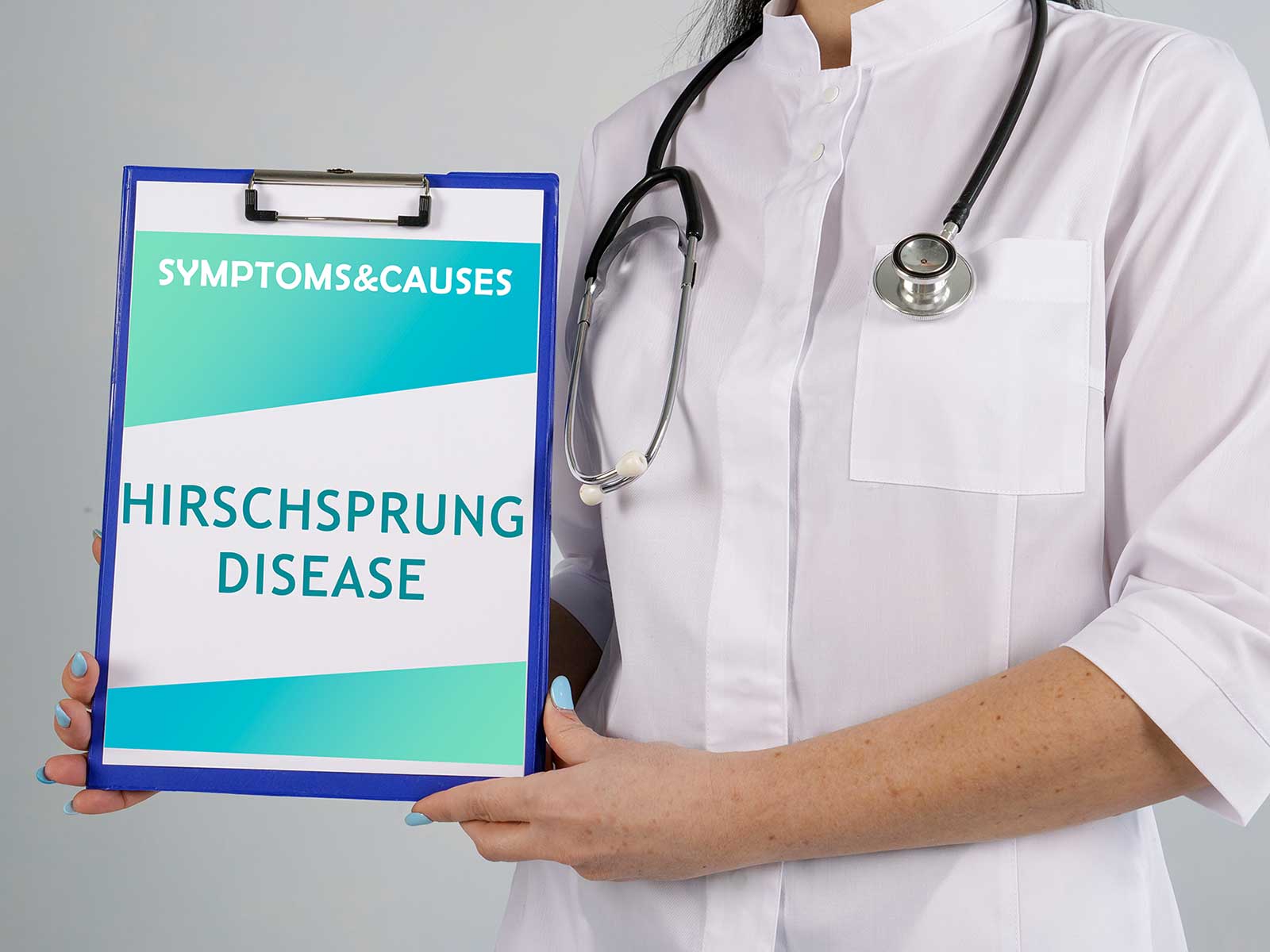 Hirschsprung's