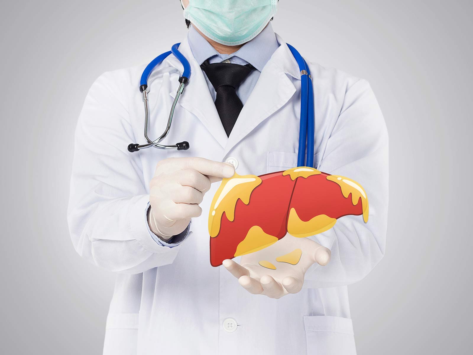 NAFLD